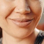 입술 포다이스 반: 혹시 성병…?? 사실은…